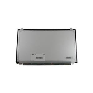 MicroScreen - 15.6 (39,6 cm) LED WXGA HDD glänzendes Anzeigefeld